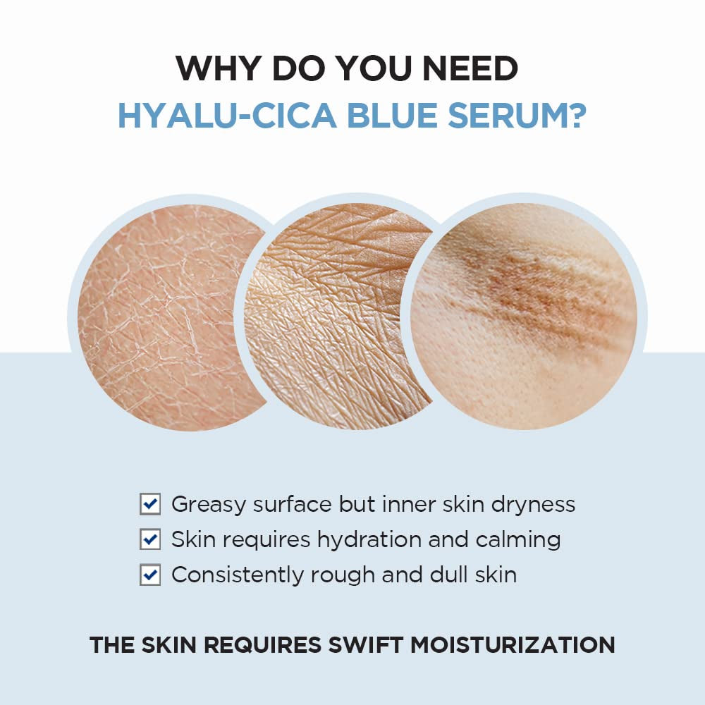 SKIN1004 Hyalu-Cica Blue Serum 1.69 Fl.Oz, 50Ml, 5 Layer Hyaluronic Acid Cica Niacinamide, Hydrating and Refreshing Multi-Care Solutions