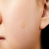 COSRX Acne Pimple Master Patch, 24 Ct