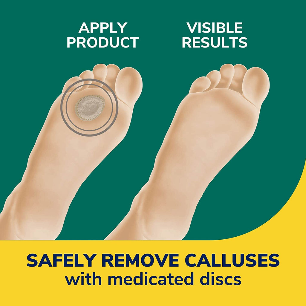 "Ultimate Callus Remover: Dr. Scholl's Extra Thick Pads - Softens Hard Calluses and Provides All-Day Pain Relief - Pack of 4"