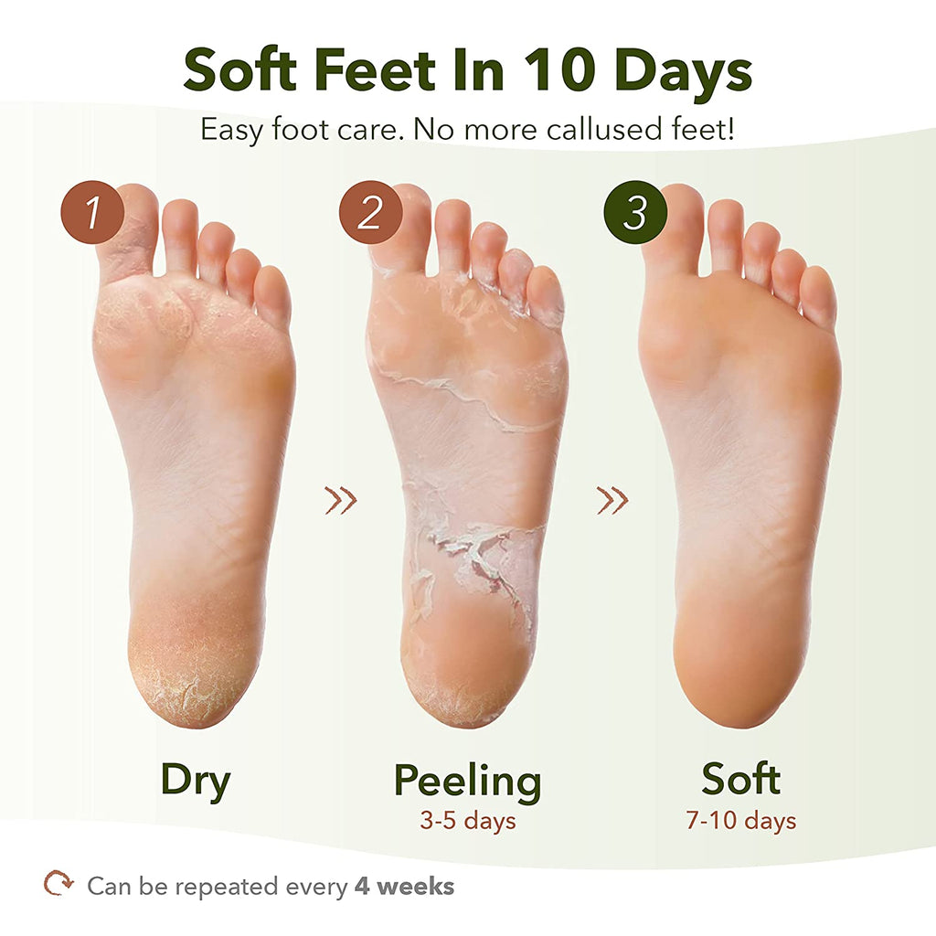 "Get Silky Smooth Feet with Purederm Shiny & Soft Foot Peeling Mask - 3 Pack - Experience the Ultimate Exfoliating Foot Peel Spa Mask for Baby Soft Skin!"