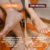 "FEETS Foot Peel Mask: Ultimate Dead Skin Remover with Soothing Eucalyptus and Lavender | 2-Pack for Smooth, Beautiful Feet | Ideal for Men and Women | Repair Dry, Rough Heels and Banish Calluses"