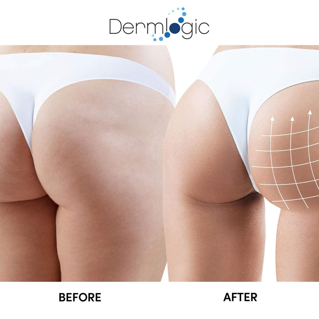 Butt Enhancement & Enlargement Cream- Clinically Proven for Bigger, Fuller, Buttocks, Hips & Thighs. Firms, Plumps & Lifts Your Booty. Natural Enhancer for Men & Women.