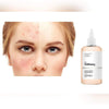 The Ordinary Glycolic Acid 7% Toning Solution - 8.12fl.oz/240ml- Original The Ordinary Imported From Canada