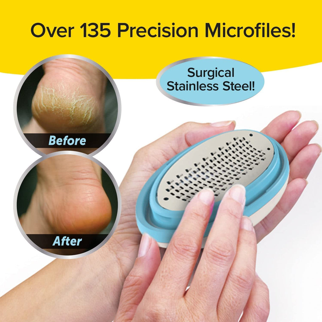 "Get Beautifully Smooth Feet with the Ped Egg Classic Callus Remover - As Seen on TV! Painlessly Remove Tough Calluses and Dry Skin with 135 Precision Micro-Blades. No Mess, No Pain, Just Soft, Smooth Feet!"