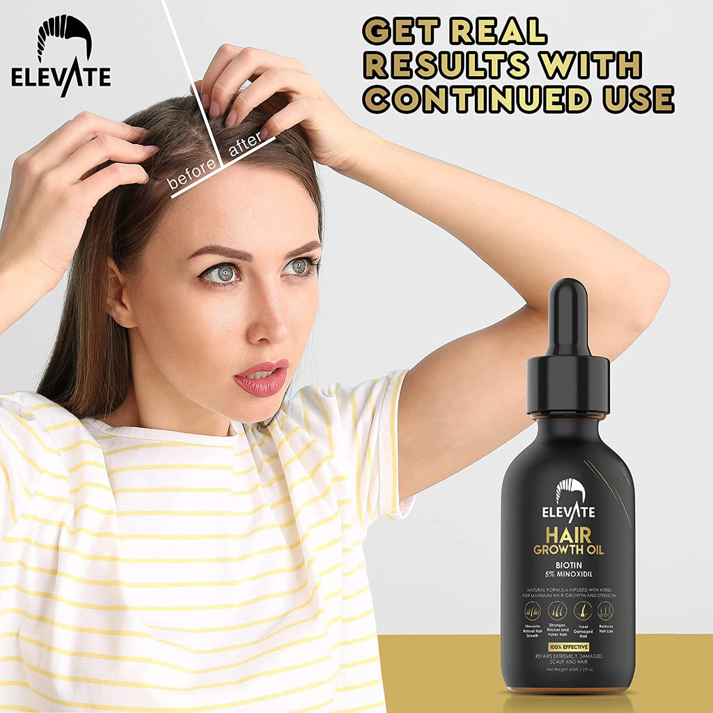 ELEVATE Hair Growth Oil - Biotin Serum & 5% Minoxidil Treatment for Stronger Thicker Longer Hair – Natural Hair Growth Thickening Treatment - Stop Thinning & Hair Loss for Men & Women 1Oz