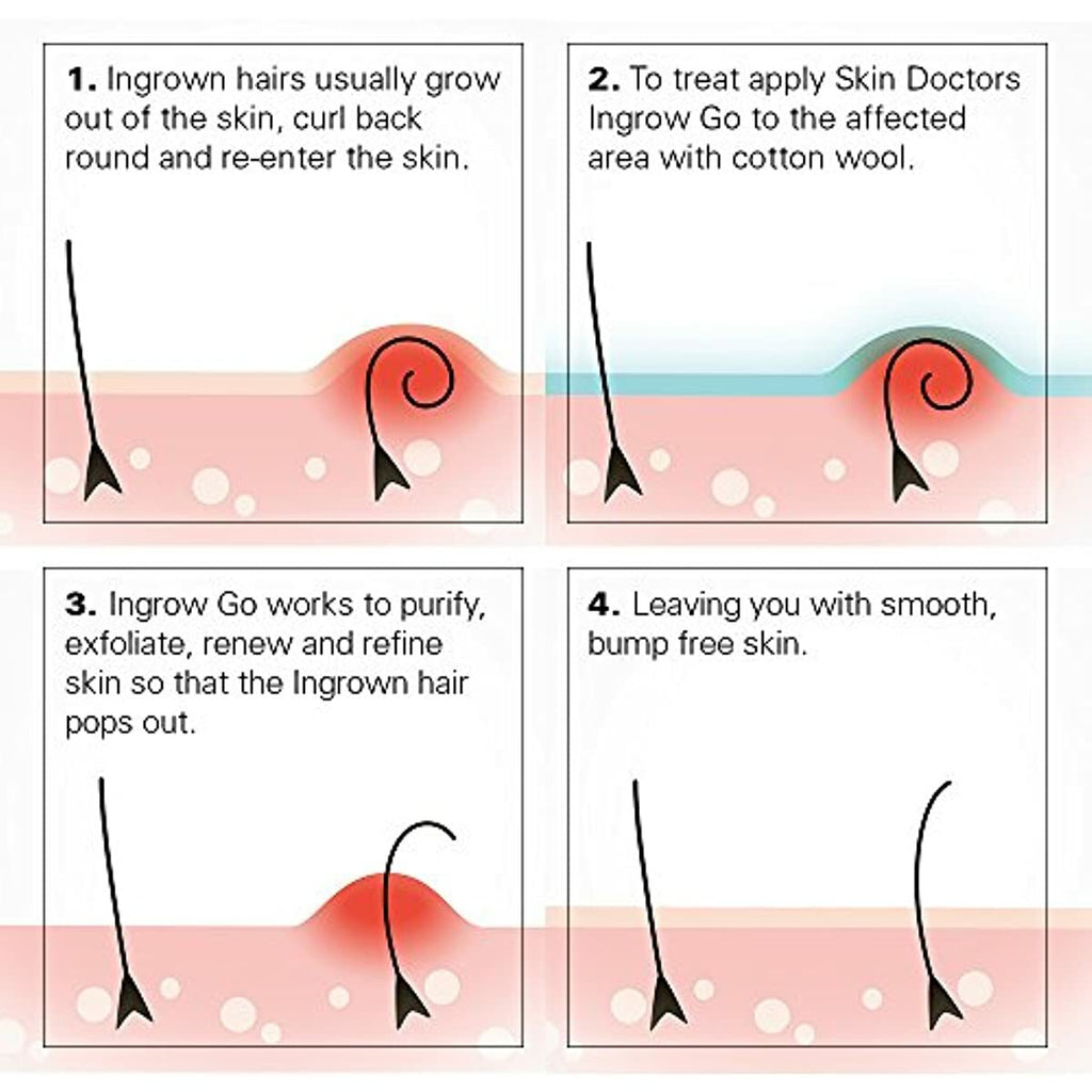 Skin Doctors Ingrow Go Ingrown Hair Lotion 120mls