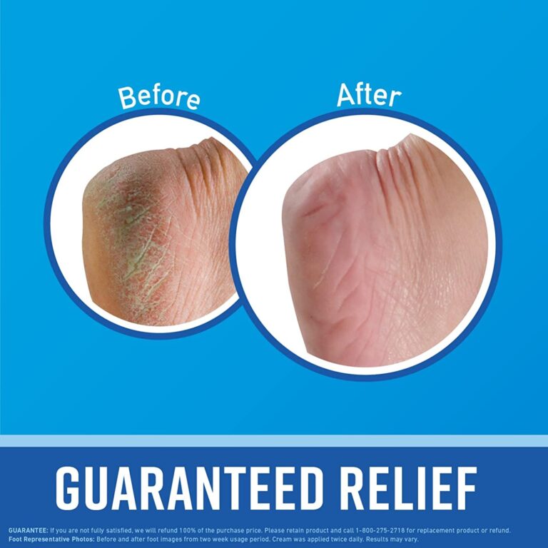 "Ultimate Foot Care: O'Keeffe's Guaranteed Relief for Dry, Cracked Feet - Instant Moisture Boost, Value Size (Pack of 2)"