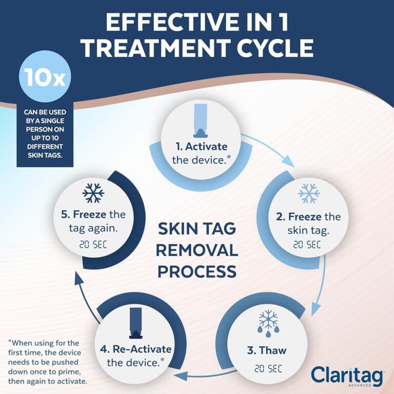 Advanced Skin Tag Remover - Fda-Cleared Device - Only for Skin Tag Removal - Works in 7-14 Days - up to 10 Treatment Cycles - Cryogenic Freeze-Off Kit