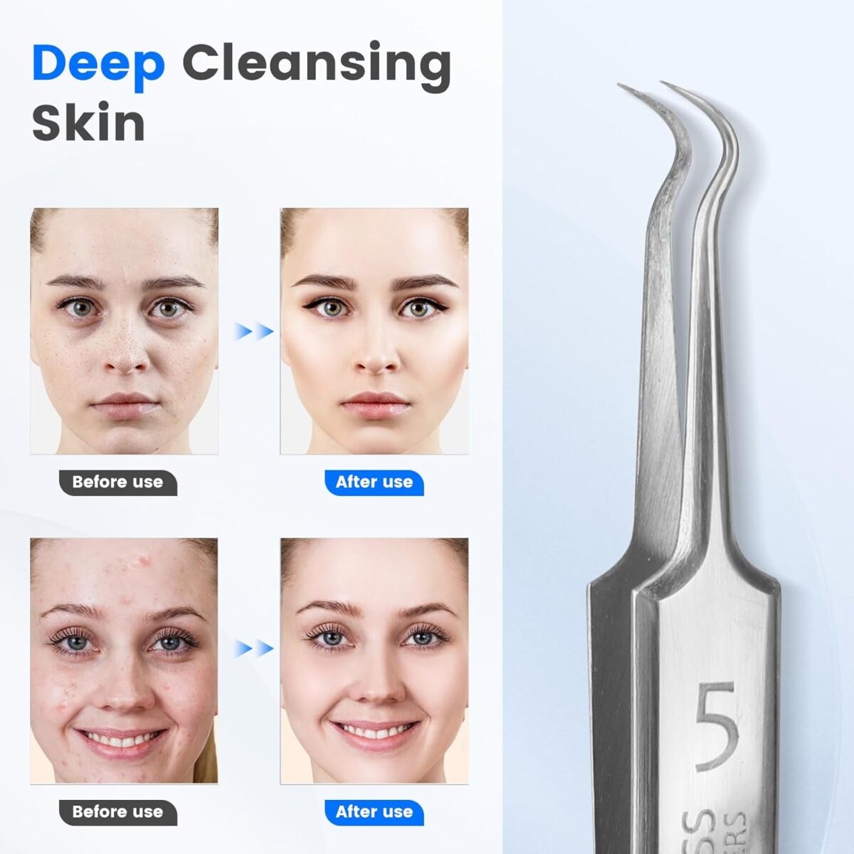 Visual Black Head Remover for Face Tool with Camera,Hd Camera,20 Times Magnification 1080P,Suitable for Women and Men,Pore Cleaner (White) (Silver)